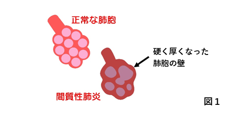 図1:肺胞