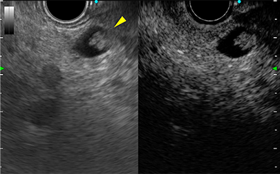 CTスキャン画像