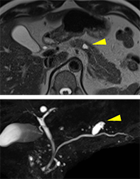 CTスキャン画像