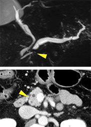 CTスキャン画像