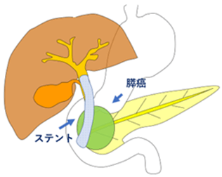 胆汁の流れのイラスト