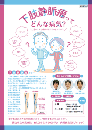 下肢静脈瘤チラシ画像