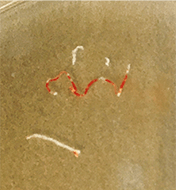 採取された検体