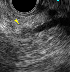 CTスキャン画像