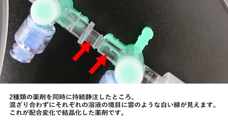 写真:薬剤を持続静注している